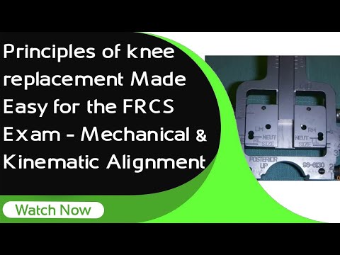 Principles of Knee Replacement