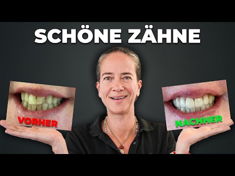 Endlich schöne Zähne: Die schnelle Lösung für dein perfektes Lachen