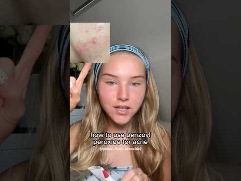 how to use BENZOYL peroxide for CLEAR SKIN!😍 #acne