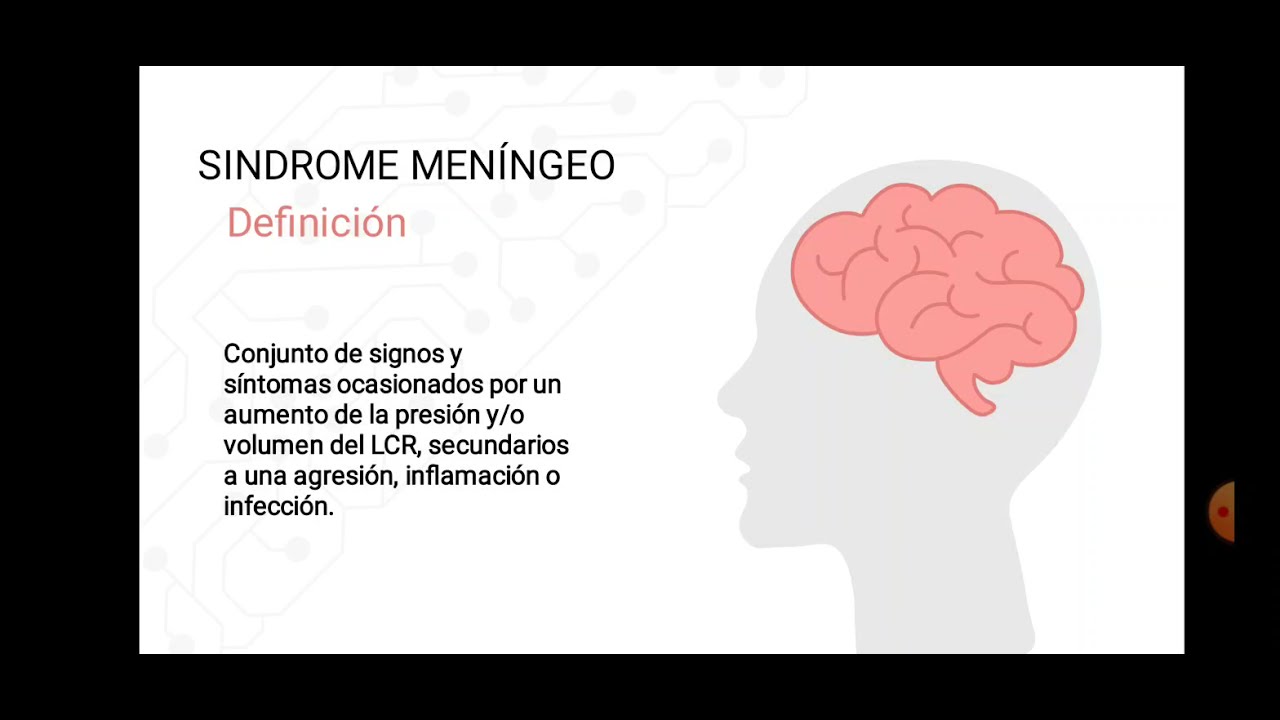 Síndrome meníngeo | Semiología