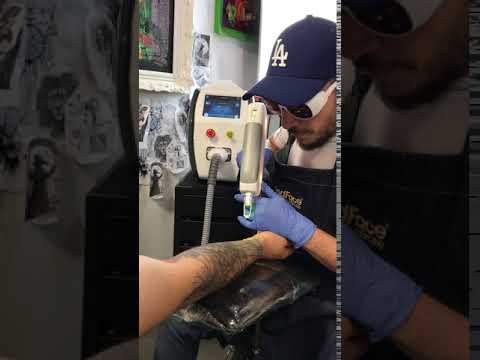 Tattoo Removal Laser Machine