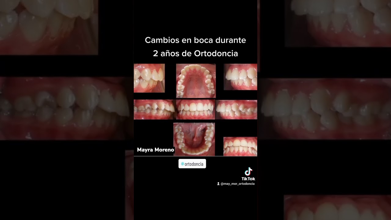 Mayra Moreno Rojas-13