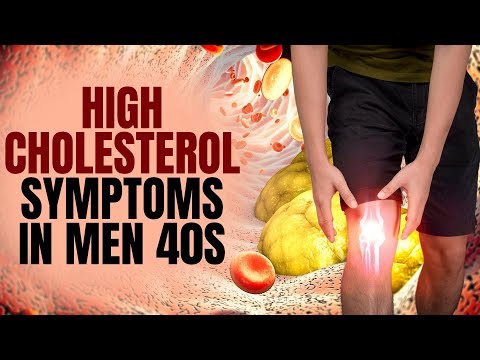Cholesterol Leg Symptoms: Warning Signs Of High Bad Cholesterol Levels