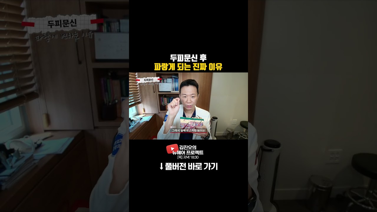 头皮纹发后变蓝的真正原因