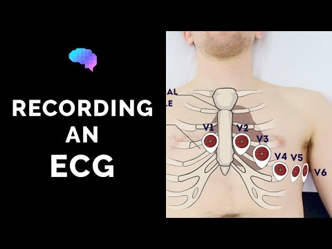 Download How To Do Ecg Procedures 3gp Mp4 Codedwap