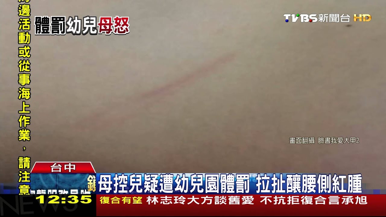 兒遭體罰被連打2次 做媽的「看不下去」