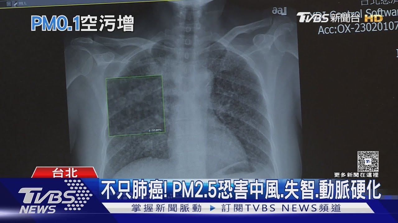 空污危害超乎想像！醫揭與失智症高度相關　WHO證實這件事！　　
