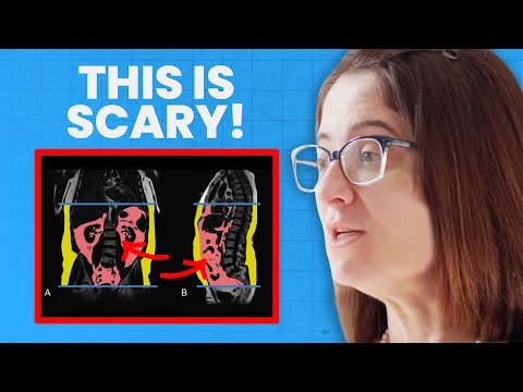 Radiologist EXPOSES Dangerous Fat HIDDEN in Your Body! | Dr. Ana Rosa