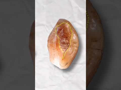 How Did Ancient Civilizations Treat Cavities?