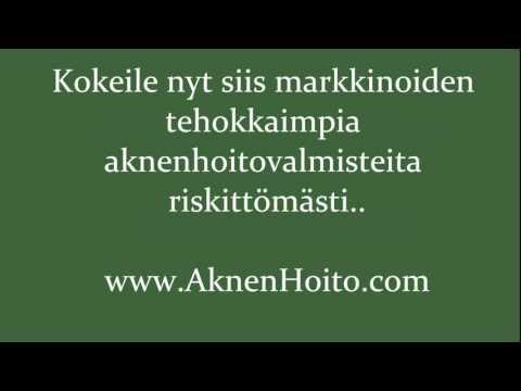 , title : 'Kuinka hoitaa aknea ja päästä aknesta eroon iäksi!'