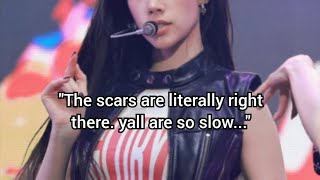 Popular Female Idol Blasted With Plastic Surgery Allegations #Kpop