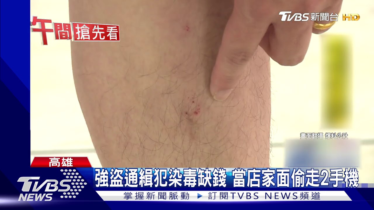 假買哀鳳真偷手機　賊落網反抗　警受傷縫針