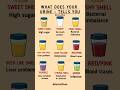 What Your Urine Color and Smell Say About Your Health | Early Sign You Shouldn’t Ignore #healthylife