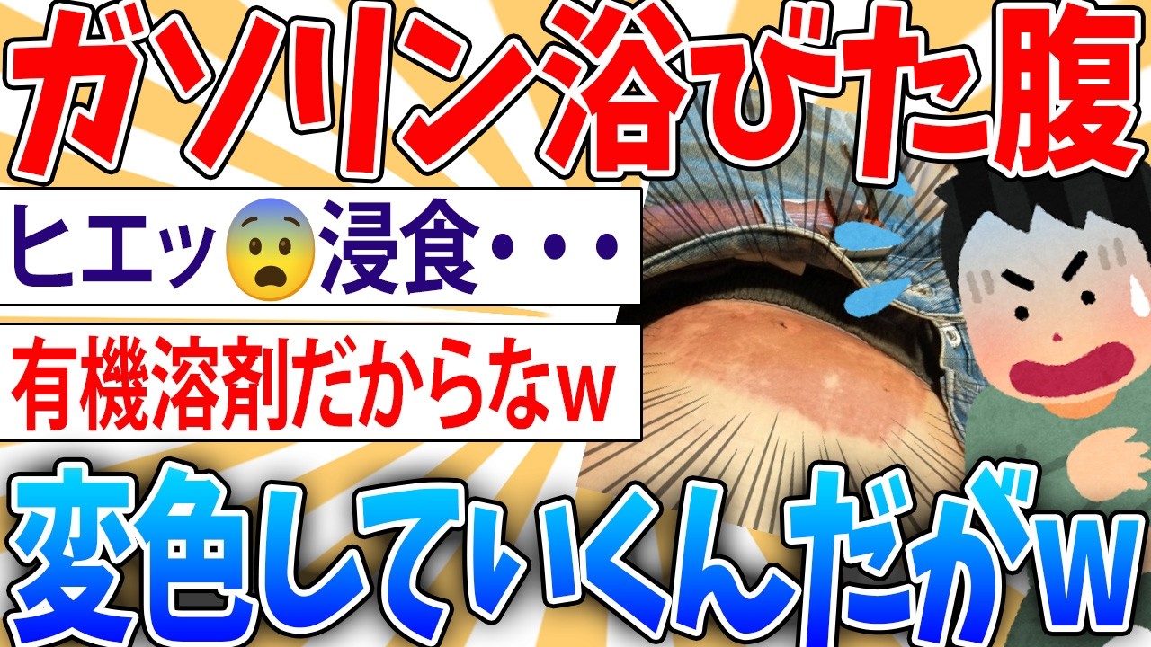 【悲報】ガソリンを腹に浴びたワイの腹　日に日に変色してく【2ch面白いスレ】