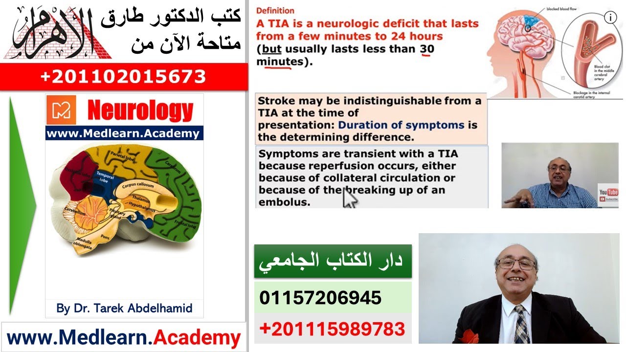 Transient Ischemic attack TIAs (Part 1)