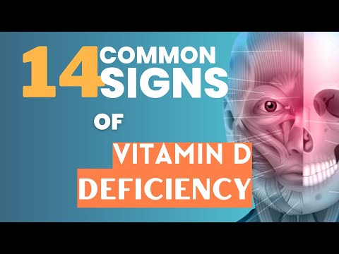 14 Common SINGS  of Vitamin D Deficiency