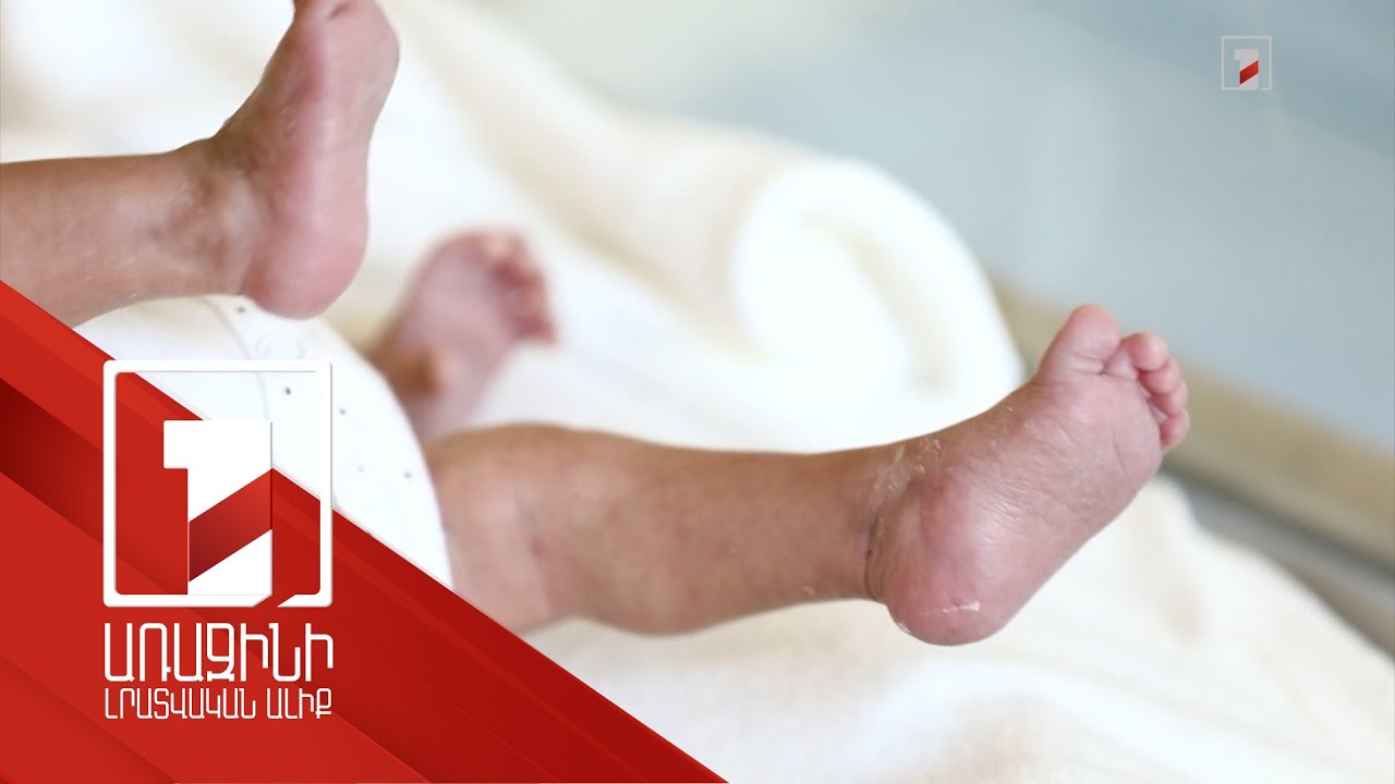 Սեռով պայմանավորված հղիության ընդհատումները վերջին տարիներին նվազել են