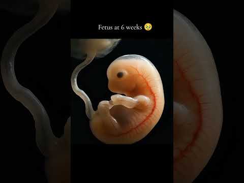 Fetus at 6 weeks 🥹 #baby #babyactivities #pregnant