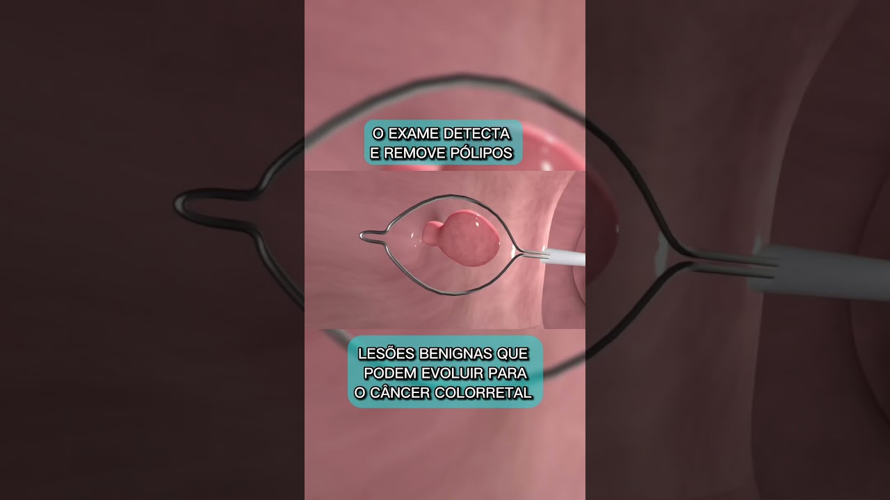 Jefferson Paes De Andrade-41