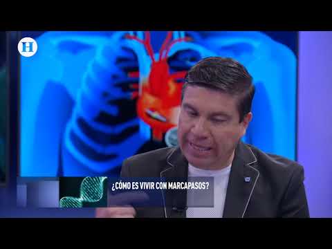 ¿En qué circunstancias se puede  llegar a usar un marcapasos?