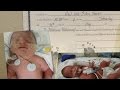 Conjoined Twins Born from Set of Identical Triplets | Good Morning America | ABC News
