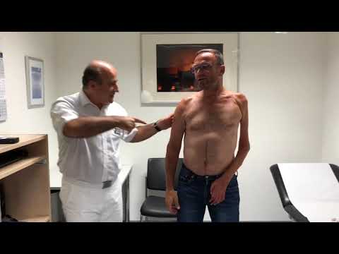 Schulterprothese Inverse Prothese