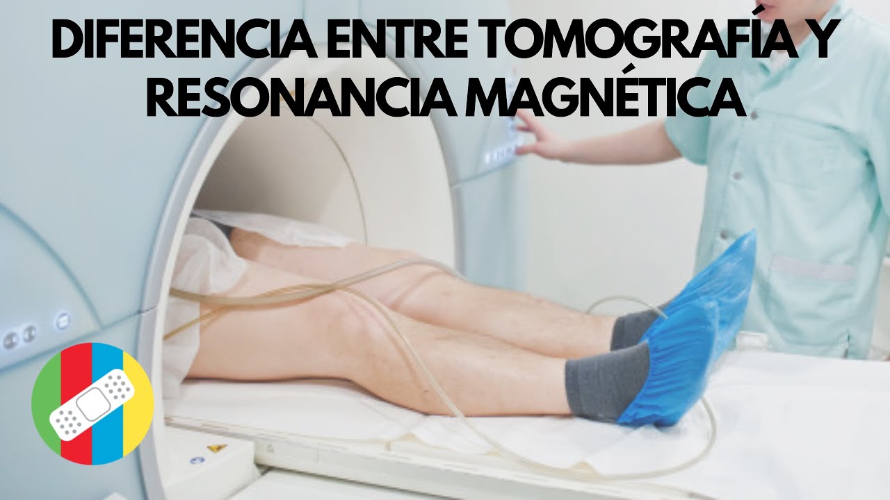 DIFERENCIA ENTRE TOMOGRAFÍA Y RESONANCIA MAGNÉTICA