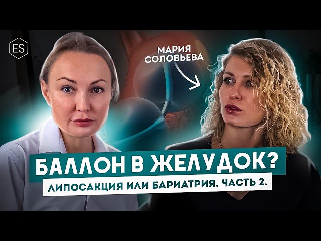 БАЛЛОН в желудок? Липосакция или бариатрия? — Мария Соловьева, бариатрический хирург. Часть 2.