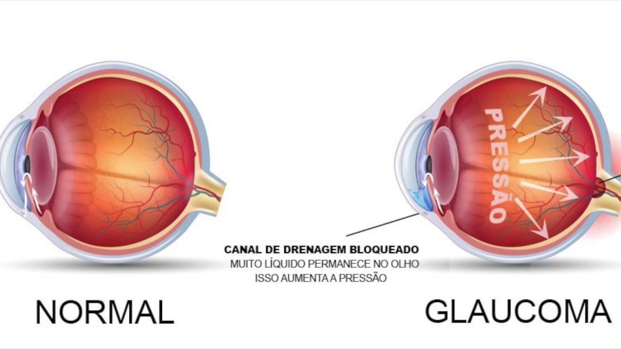 Raphael Montesinos-22
