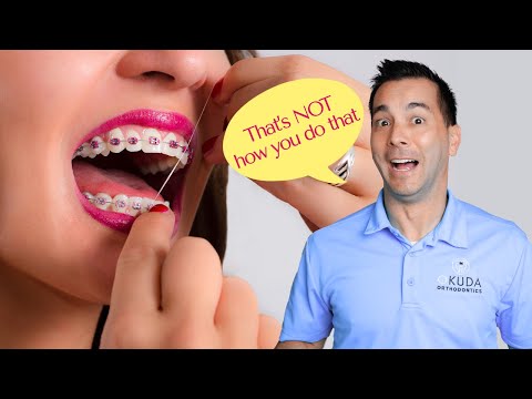 How to Floss with Braces | Water Flosser vs. String Floss