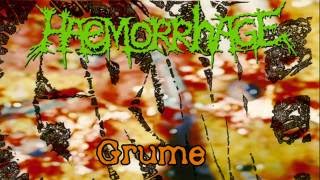 Haemorrhage - Intravenous molestation of the obstructionist arteries (o-pus II)