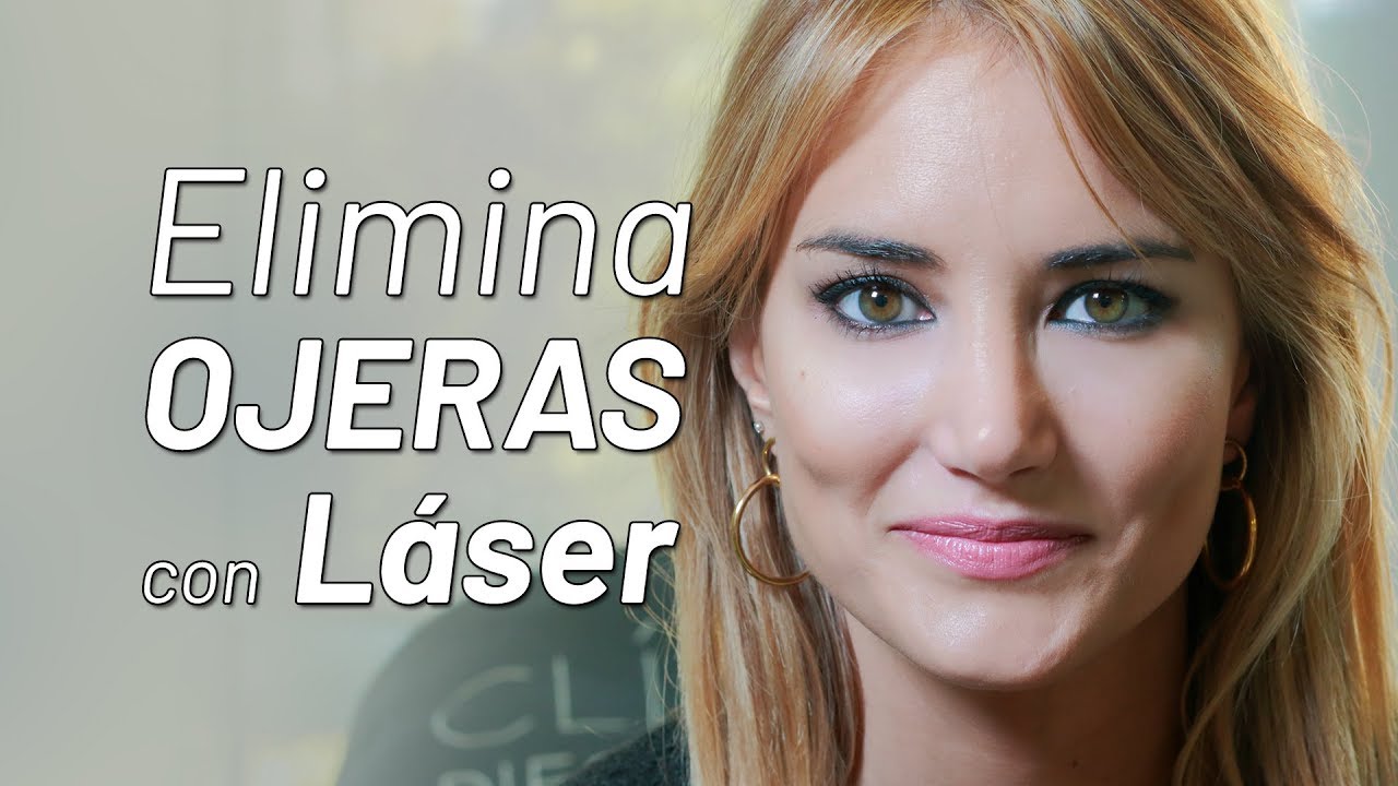 Alba Carrillo se quita las Ojeras Oscuras con Láser | Clínicas Diego de León