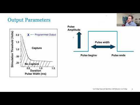 Pacemaker Electrical Concepts & Basic Timing Cycles - Port Harcourt Pacing