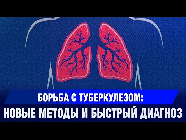 Борьба с туберкулёзом: новые методы и быстрый диагноз