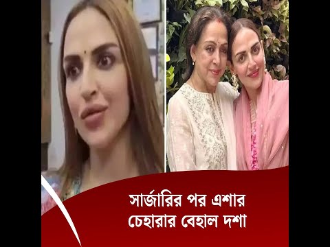 সার্জারির পর এশার চেহারার বেহাল দশা