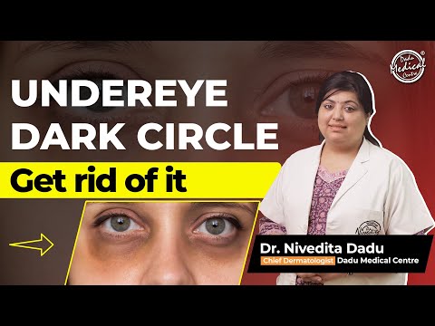 Dark Circles Treatment