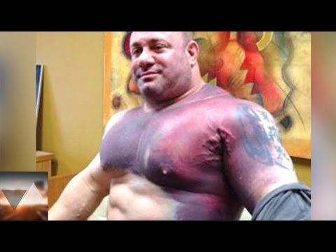 Penis 100 percento Ho preso lagente patogeno femminile