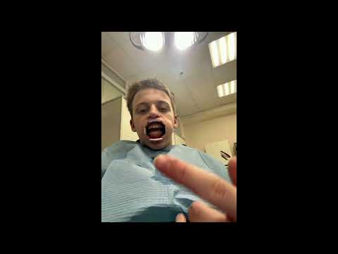 Baby Melo, Spyrofoam - RIP