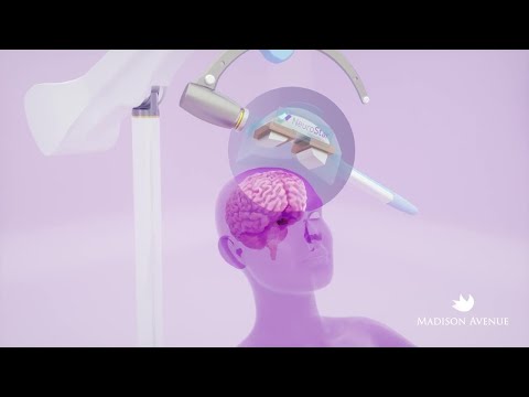 How TMS Works: A Step-by-Step Explanation of How Transcranial Magnetic Stimulation Treats Depression