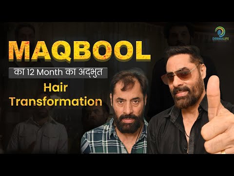Shaji Hair Transplant | Celebrity Hair Transplant Clinic in India |Celebrity Hair Transplant Surgeon