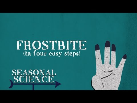 Frostbite | Seasonal Science | UNC-TV