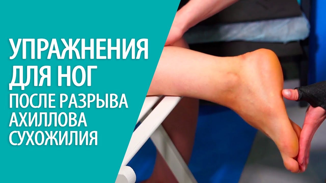 Видео по теме Разрыв Ахиллова сухожилия 
