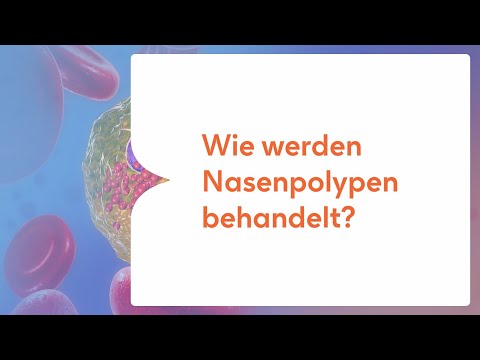 Wie werden Nasenpolypen behandelt?