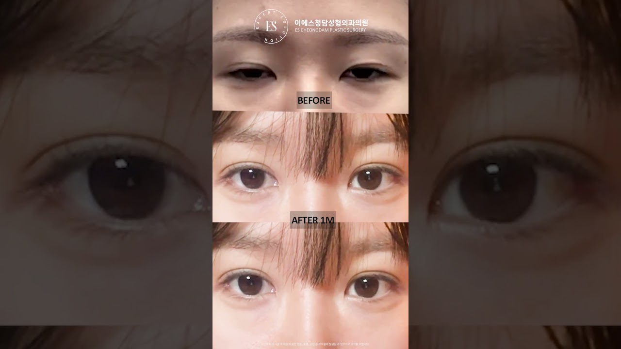 이에스 유튜브