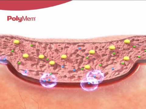 3d microbicidal composite dressing
