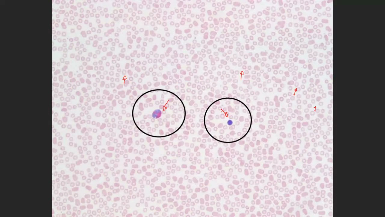 Erros Pré Analíticos e Analíticos no Laboratório de Análises Clínicas