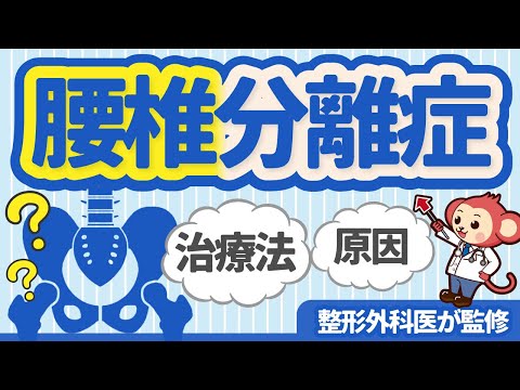 分離バリアについて詳しく解説