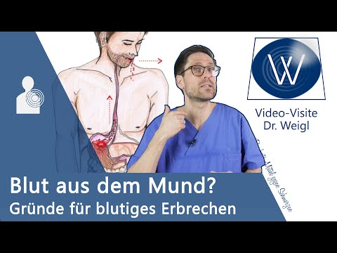 Bluterbrechen: Plötzlich Blut im Mund👆 Was kann es sein? Von Notfall über Magengeschwür bis Krebs❗