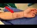 Creatures Found Living INSIDE A Human Body! Creatures Found Living INSIDE A Human Body!