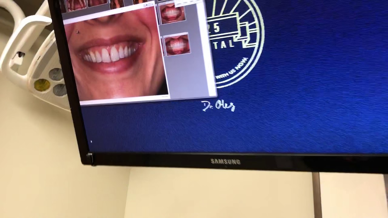 Jess’s Invisalign testimonial